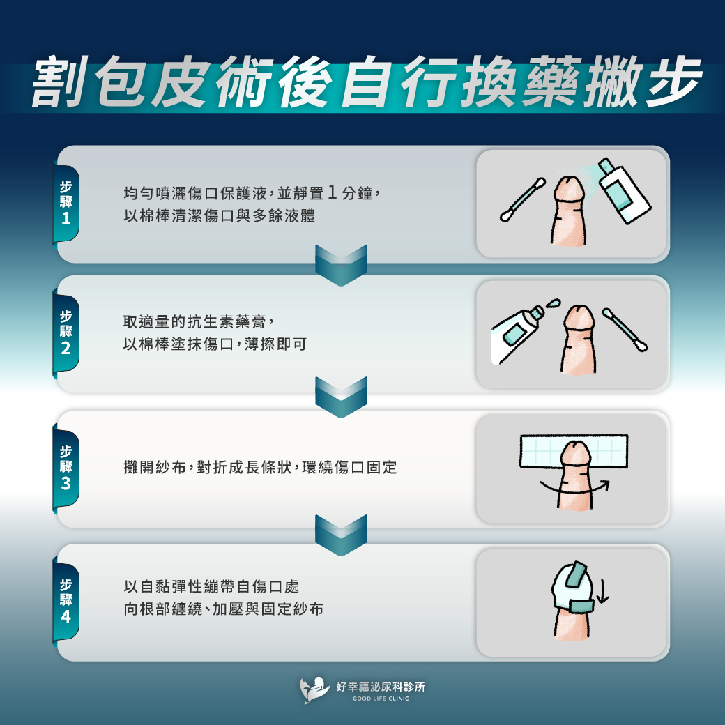 割包皮術後自行換藥步驟