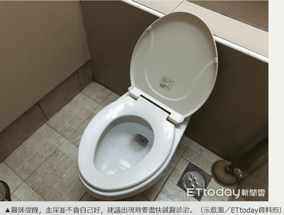 2疾病恐冒「無痛血尿」　泌尿醫：不會自己好 