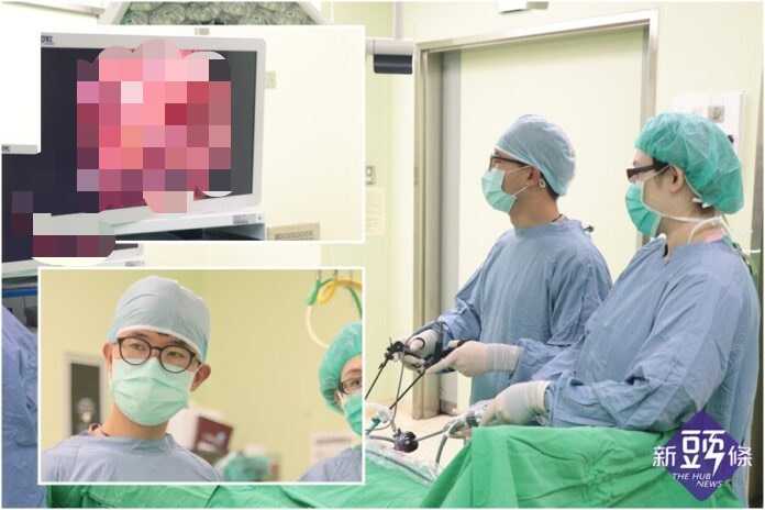 罕見子宮內膜異位侵犯膀胱 聖母醫師以微創腹腔鏡手術助婦人恢復健康