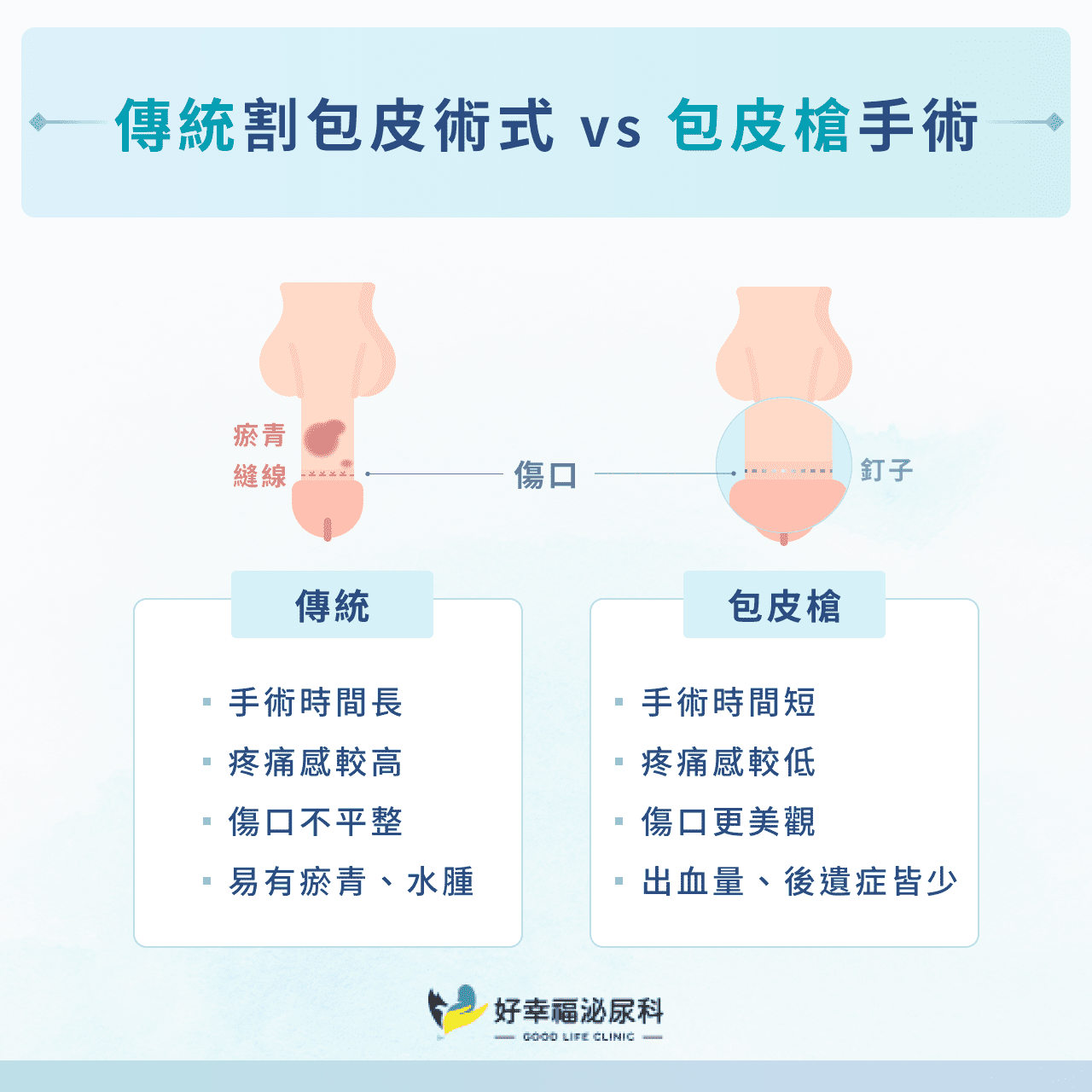 傳統割包皮術式 vs 包皮槍手術