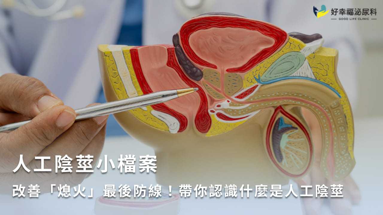 人工陰莖小檔案》改善「熄火」最後防線！帶你認識什麼是人工陰莖