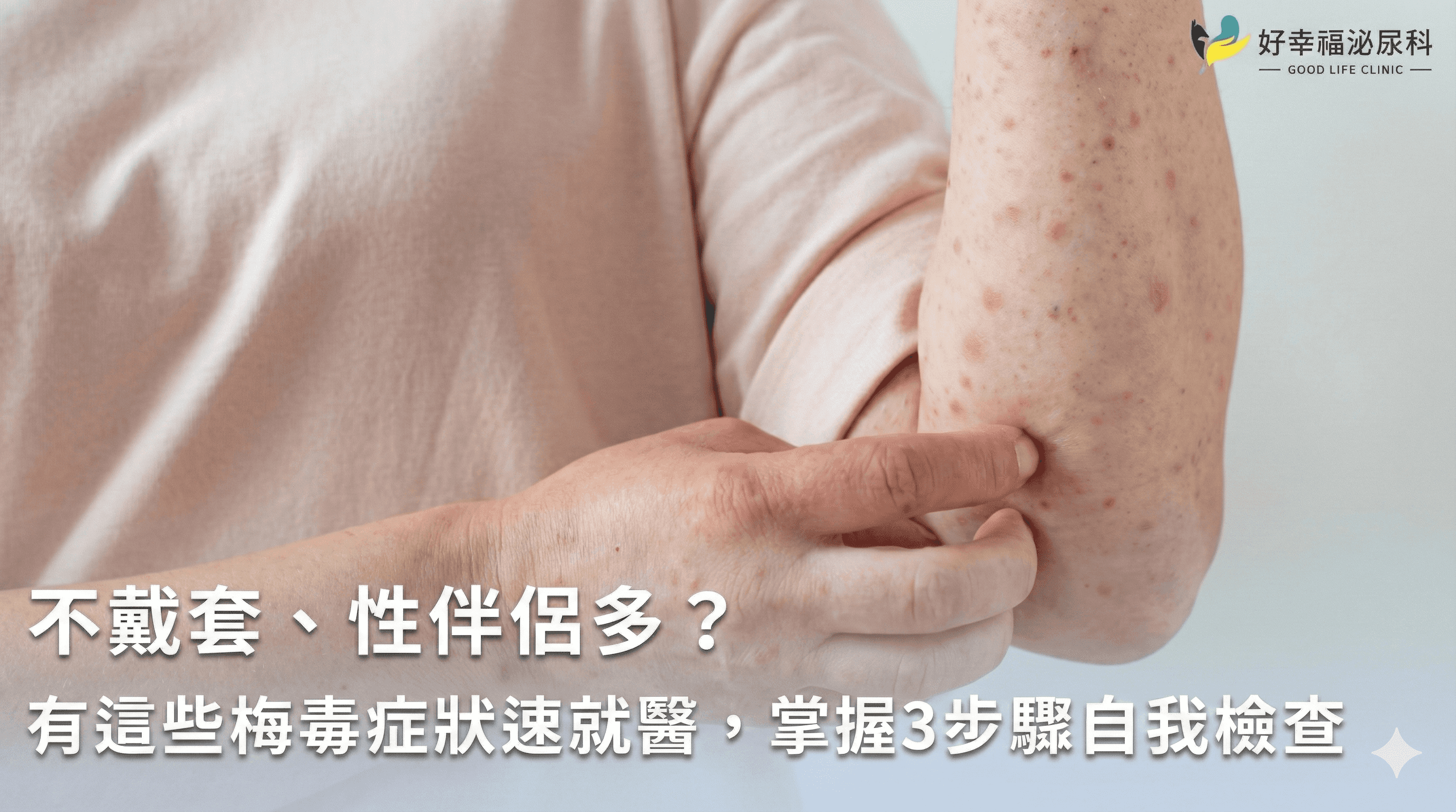 不戴套、性伴侶多？有這些梅毒症狀速就醫，掌握3步驟自我檢查