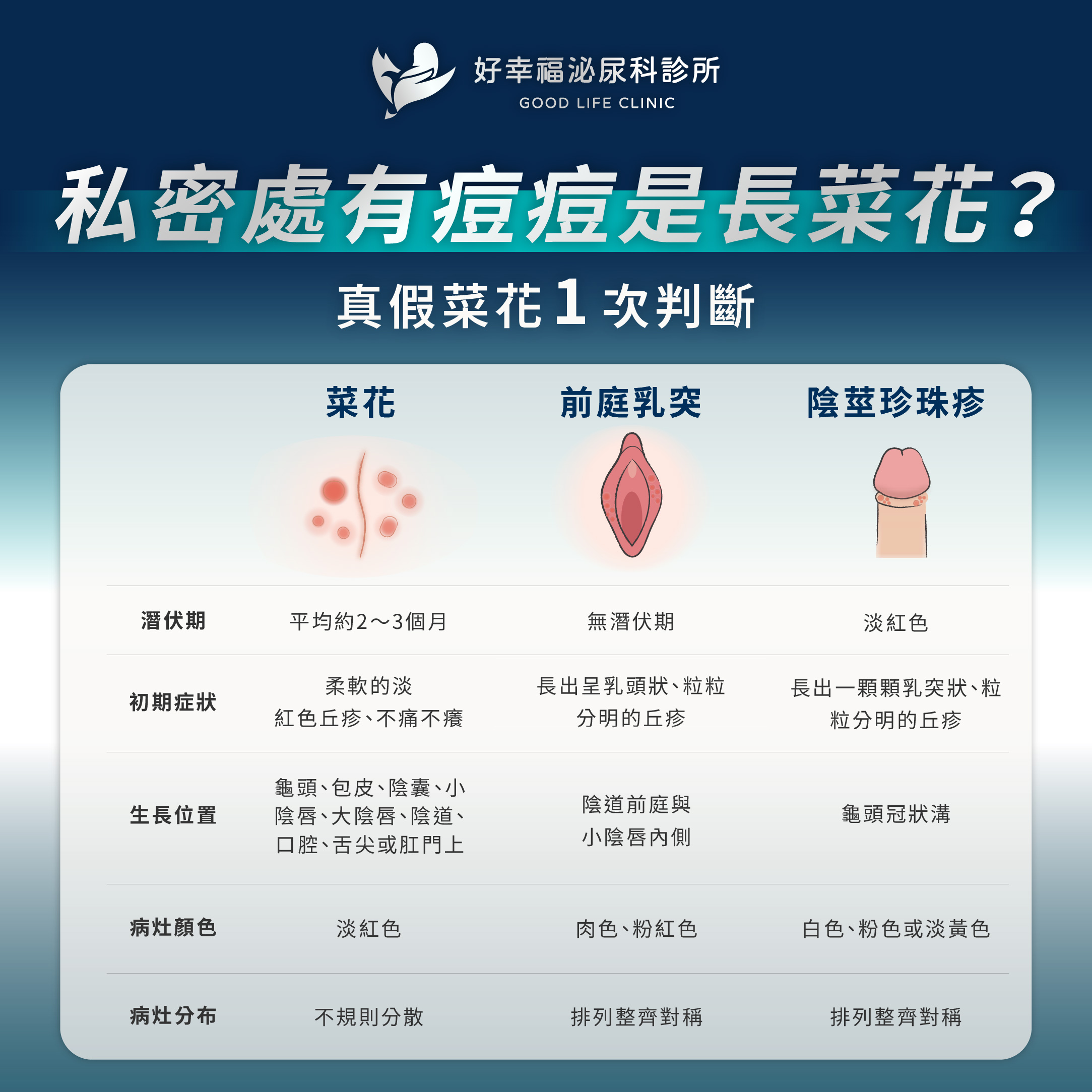 Genital warts,Vestibular Papillomatosis,Pearly Penile Papules