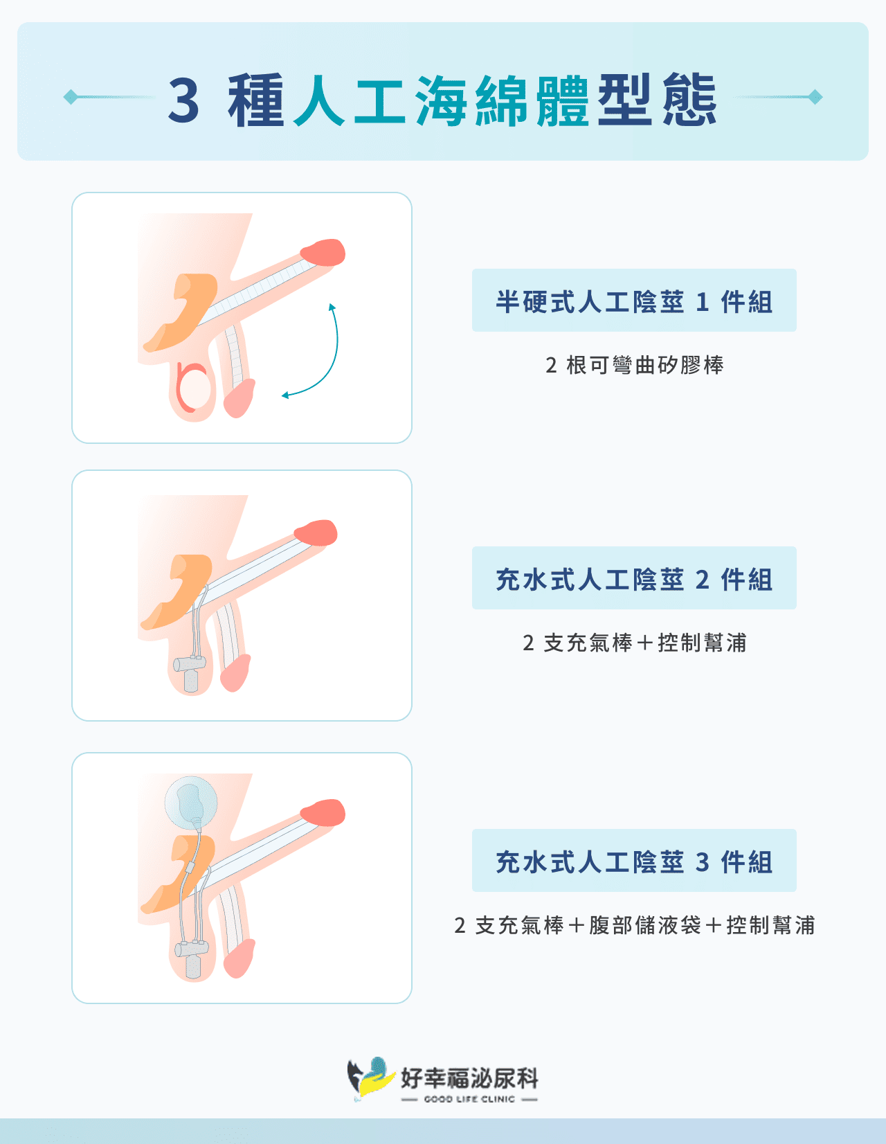 3 種人工海綿體型態