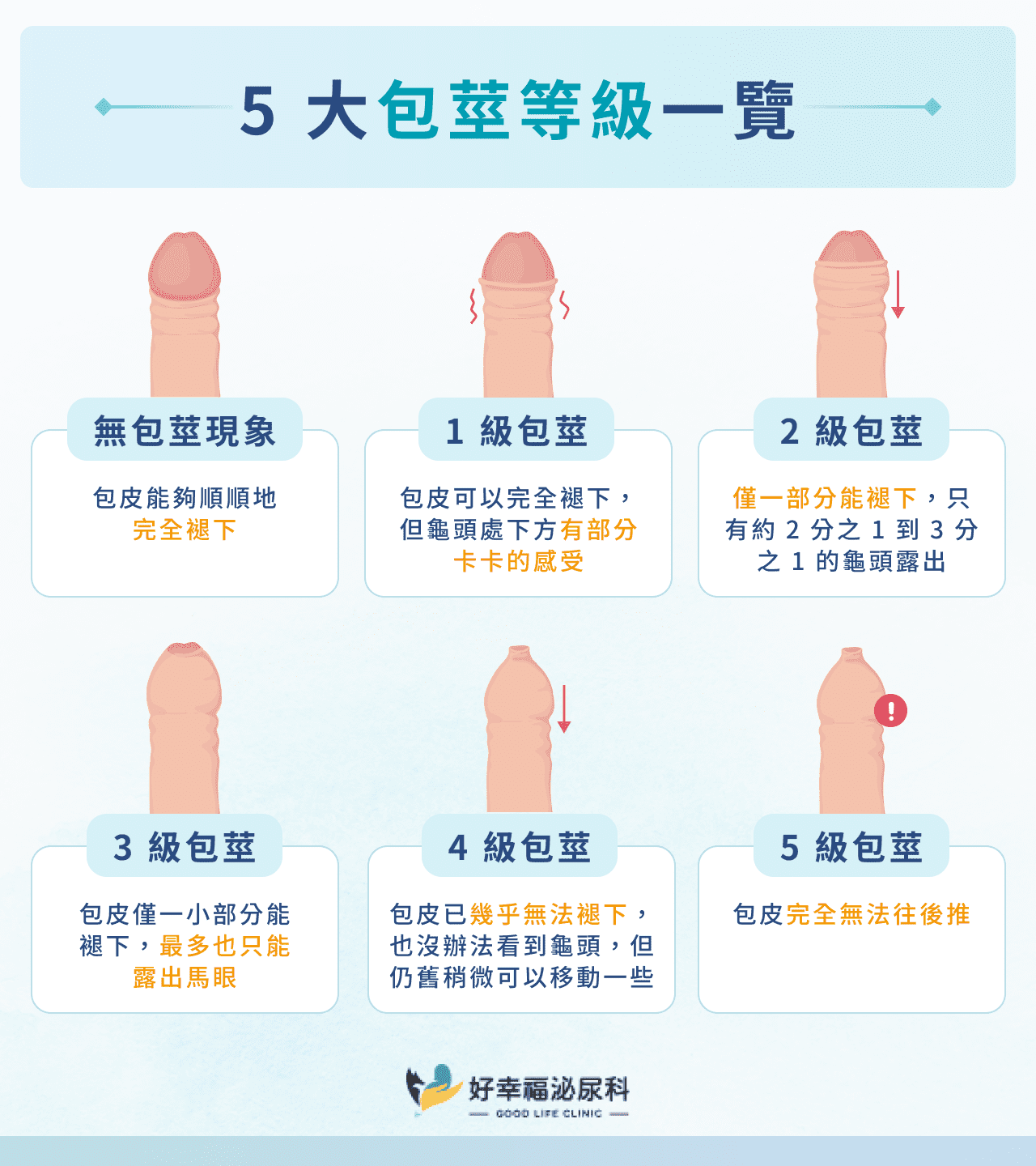 5 大包莖等級一覽
